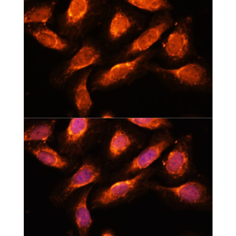 Immunofluorescence - Anti-Rab1A Antibody (A88803) - Antibodies.com