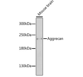 Western Blot - Anti-Aggrecan Antibody (A88804) - Antibodies.com