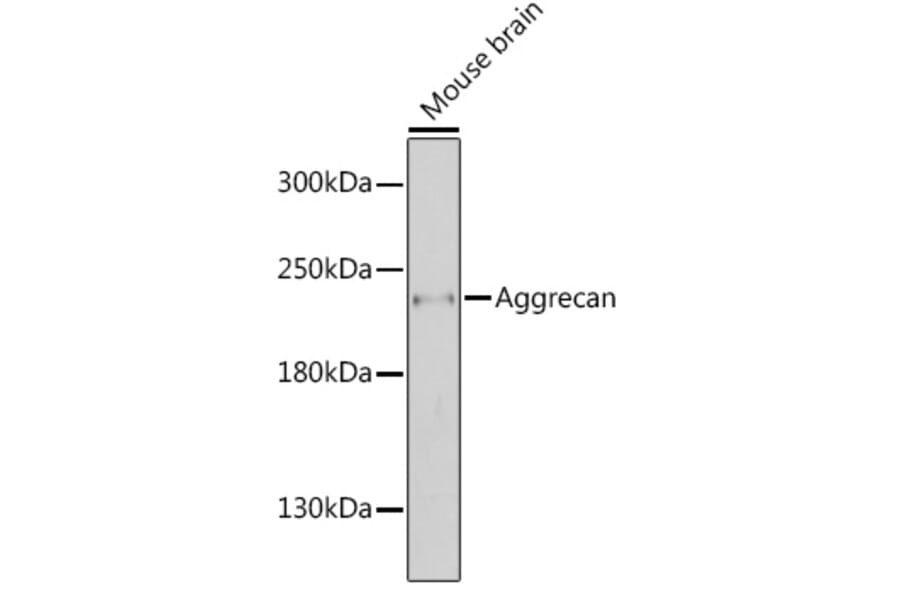 Western Blot - Anti-Aggrecan Antibody (A88804) - Antibodies.com