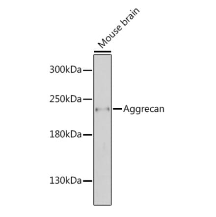 Western Blot - Anti-Aggrecan Antibody (A88804) - Antibodies.com