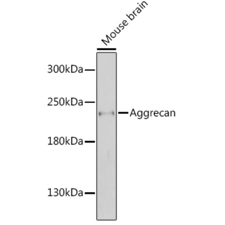 Western Blot - Anti-Aggrecan Antibody (A88804) - Antibodies.com