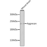 Western Blot - Anti-Aggrecan Antibody (A88804) - Antibodies.com