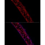 Immunofluorescence - Anti-Aggrecan Antibody (A88804) - Antibodies.com