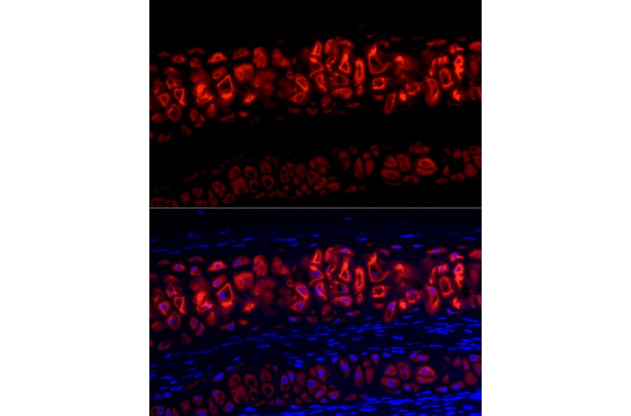 Immunofluorescence - Anti-Aggrecan Antibody (A88804) - Antibodies.com