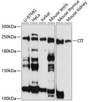 Western blot analysis of extracts of various cell lines, using Anti-CIT Antibody (A3668) at 1:3000 dilution.
Secondary antibody: Goat Anti-Rabbit IgG (H+L) (HRP) (AS014) at 1:10,000 dilution.
Lysates / proteins: 25µg per lane.
Blocking buffer: 3% non-fat dry milk in TBST.
Detection: ECL Basic Kit (RM00020).
Exposure time: 90s.