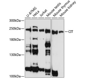 Western Blot - Anti-CIT Antibody (A88805) - Antibodies.com