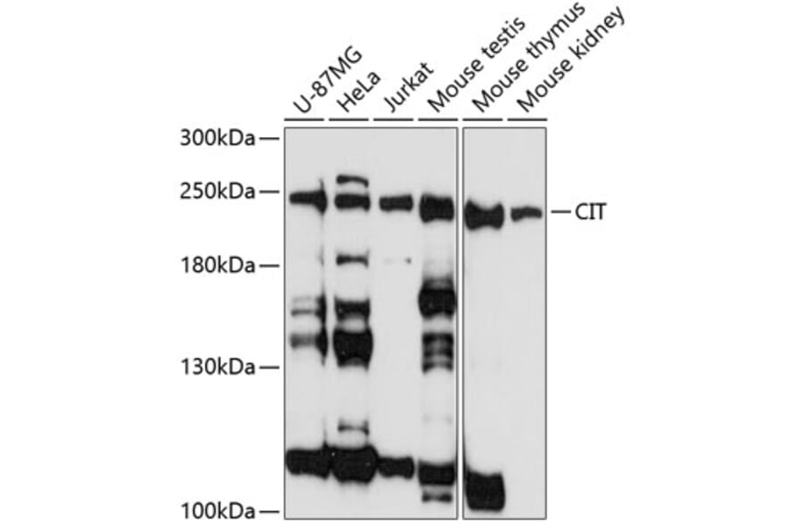 Western Blot - Anti-CIT Antibody (A88805) - Antibodies.com