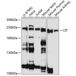 Western Blot - Anti-CIT Antibody (A88805) - Antibodies.com