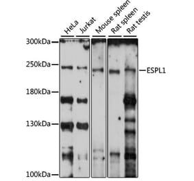 Western Blot - Anti-Separase Antibody (A88806) - Antibodies.com