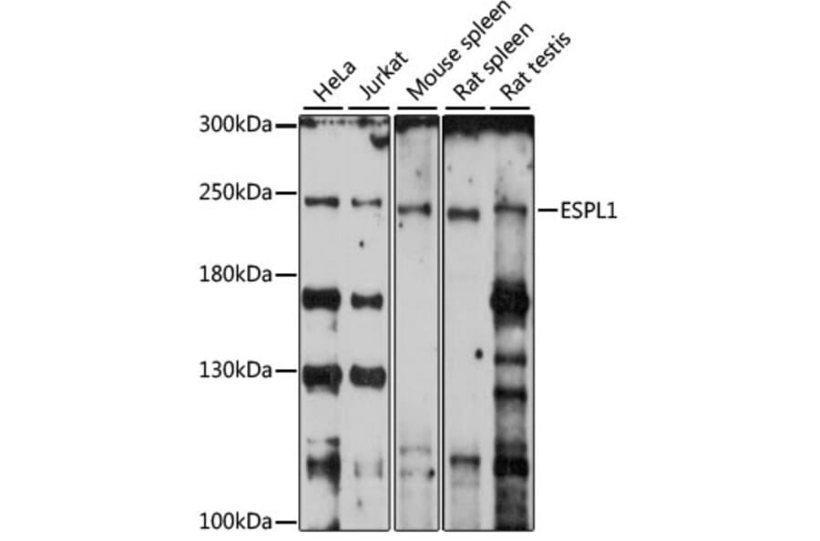 Western Blot - Anti-Separase Antibody (A88806) - Antibodies.com