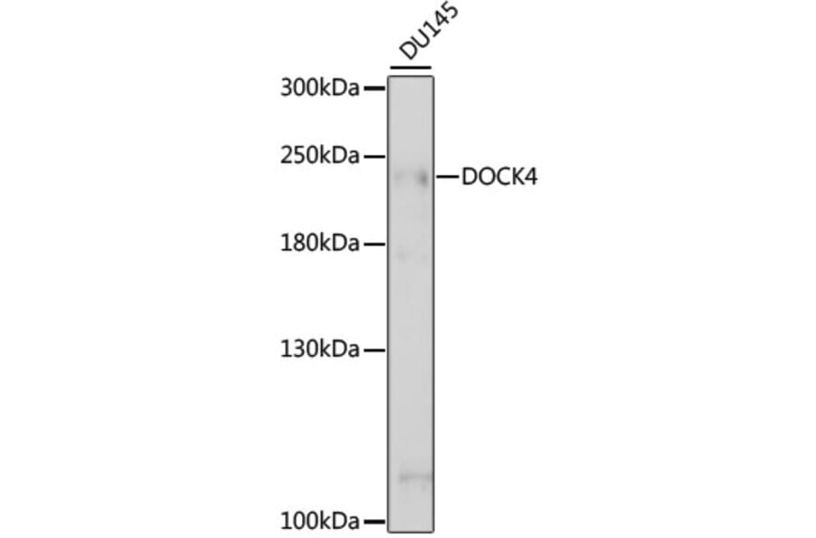 Western Blot - Anti-DOCK4 Antibody (A88807) - Antibodies.com
