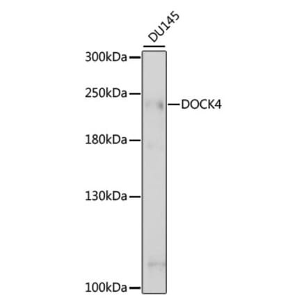 Western Blot - Anti-DOCK4 Antibody (A88807) - Antibodies.com