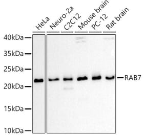 Western Blot - Anti-RAB7 Antibody (A88808) - Antibodies.com