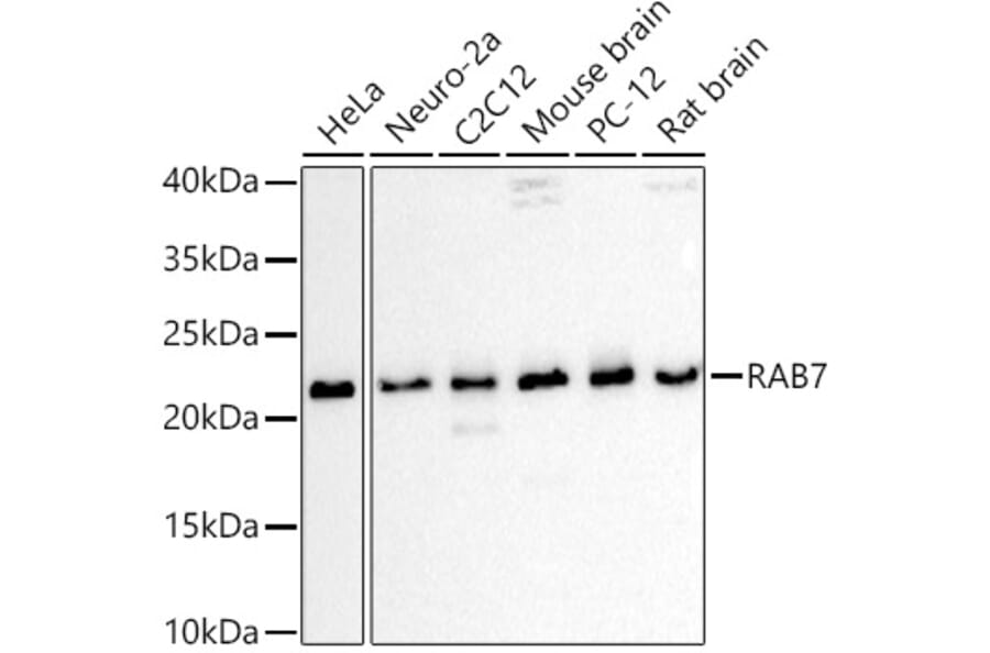 Western Blot - Anti-RAB7 Antibody (A88808) - Antibodies.com