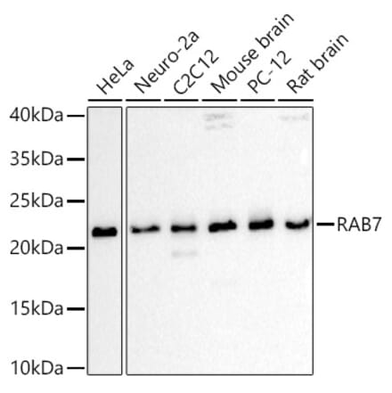 Western Blot - Anti-RAB7 Antibody (A88808) - Antibodies.com