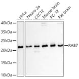 Western Blot - Anti-RAB7 Antibody (A88808) - Antibodies.com