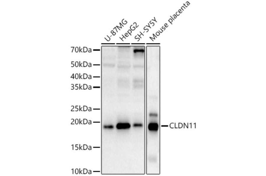 Western Blot - Anti-Oligodendrocyte Specific Protein Antibody (A88810) - Antibodies.com