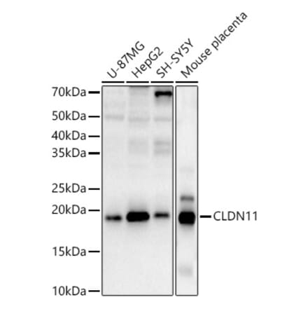 Western Blot - Anti-Oligodendrocyte Specific Protein Antibody (A88810) - Antibodies.com