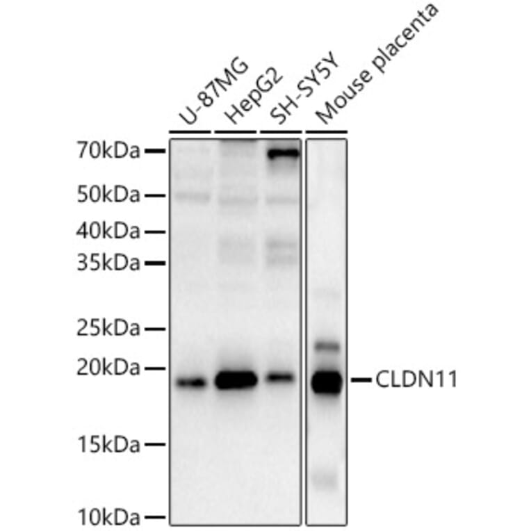 Western Blot - Anti-Oligodendrocyte Specific Protein Antibody (A88810) - Antibodies.com