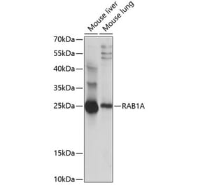 Western Blot - Anti-Rab1A Antibody (A88811) - Antibodies.com