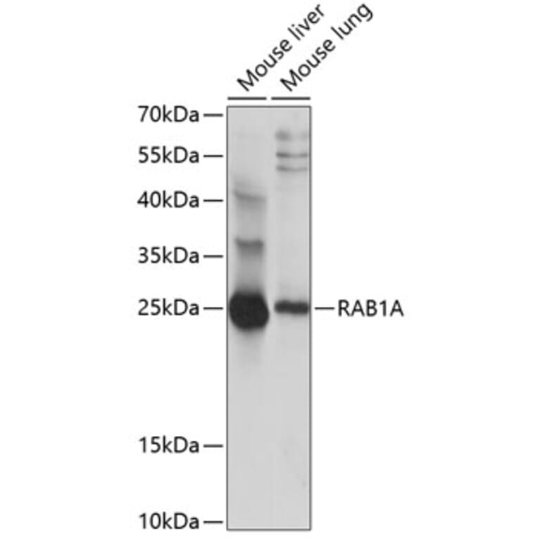 Western Blot - Anti-Rab1A Antibody (A88811) - Antibodies.com