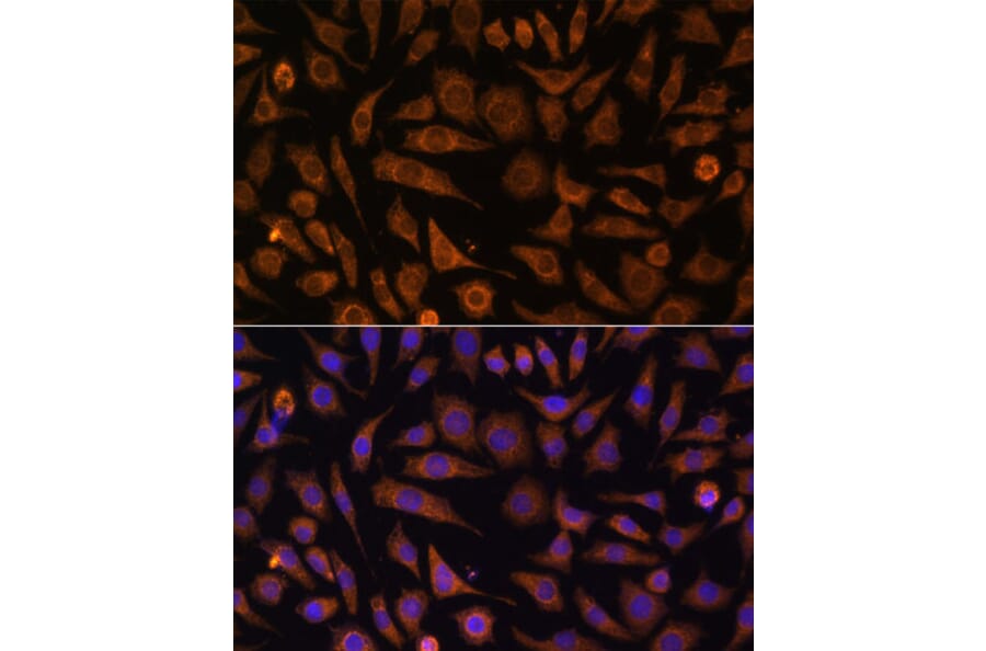 Immunofluorescence - Anti-Rab1A Antibody (A88811) - Antibodies.com