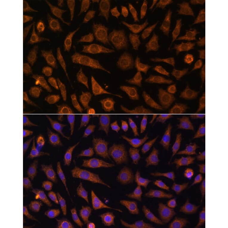 Immunofluorescence - Anti-Rab1A Antibody (A88811) - Antibodies.com