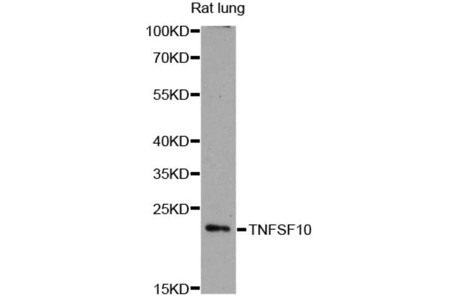 Western Blot - Anti-TNFSF10 Antibody (A11984) - Antibodies.com
