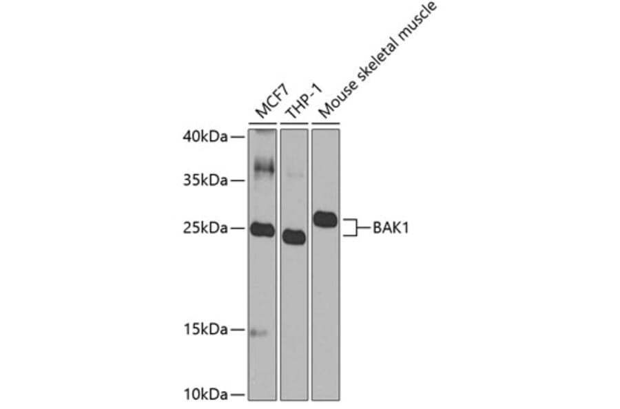 Western Blot - Anti-BAK1 Antibody (A0498) - Antibodies.com