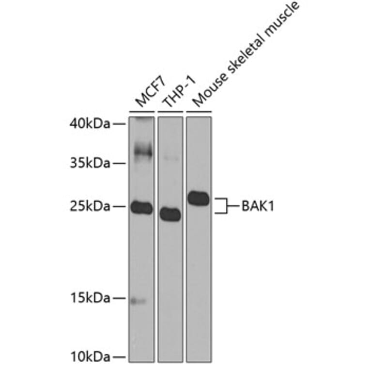 Western Blot - Anti-BAK1 Antibody (A0498) - Antibodies.com