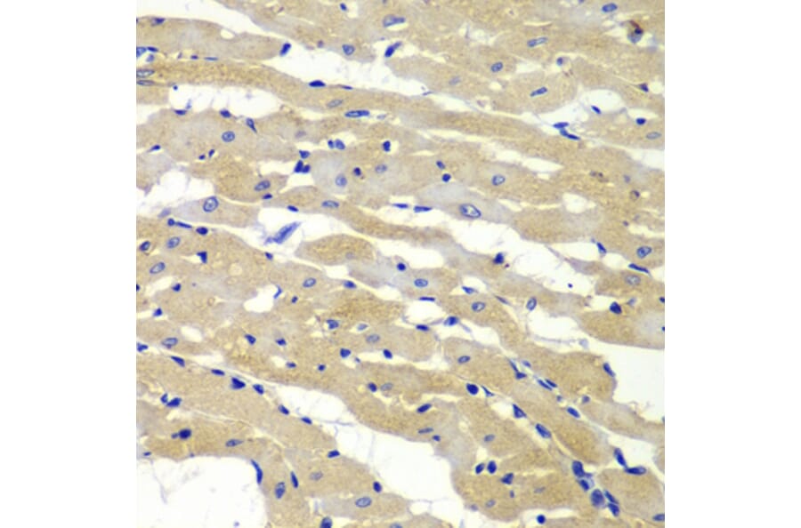 Immunohistochemistry - Anti-BAK1 Antibody (A0498) - Antibodies.com