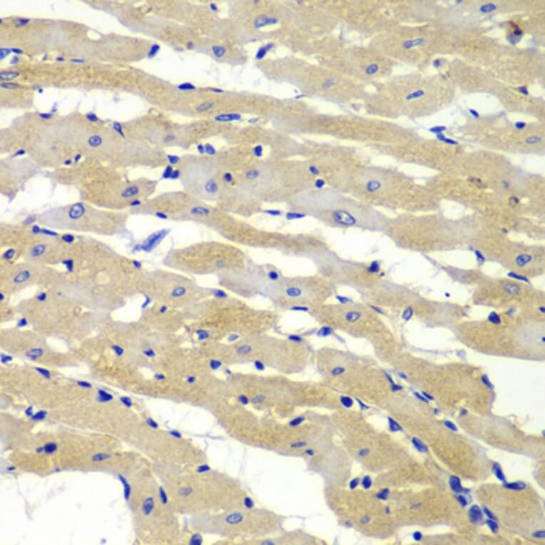 Immunohistochemistry - Anti-BAK1 Antibody (A0498) - Antibodies.com