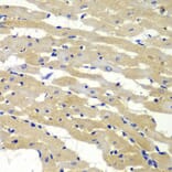 Immunohistochemistry - Anti-BAK1 Antibody (A0498) - Antibodies.com