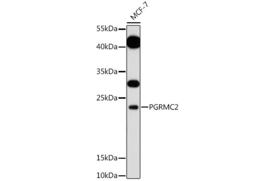 Western Blot - Anti-PGRMC2 Antibody (A88814) - Antibodies.com
