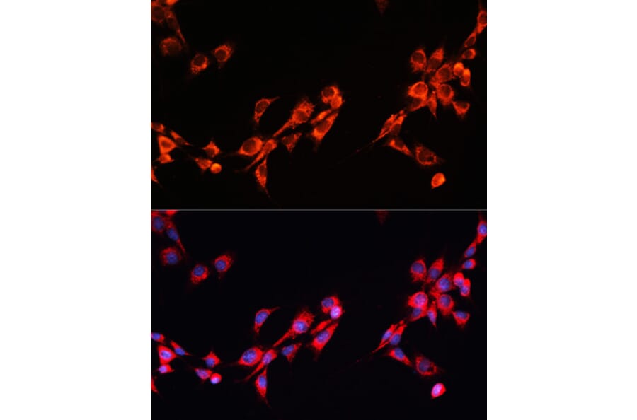 Immunofluorescence - Anti-PGRMC2 Antibody (A88814) - Antibodies.com