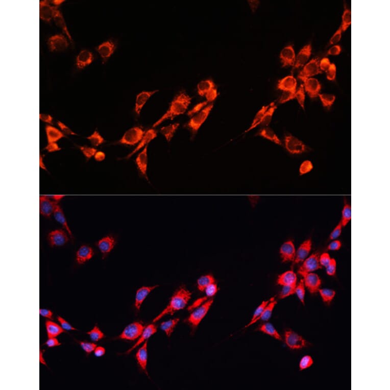Immunofluorescence - Anti-PGRMC2 Antibody (A88814) - Antibodies.com