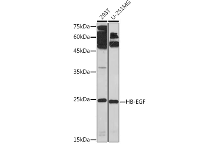 Western Blot - Anti-HBEGF / DTR Antibody (A88815) - Antibodies.com