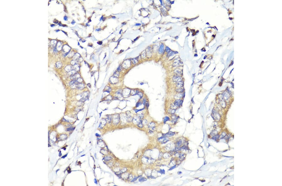 Immunohistochemistry - Anti-HBEGF / DTR Antibody (A88815) - Antibodies.com