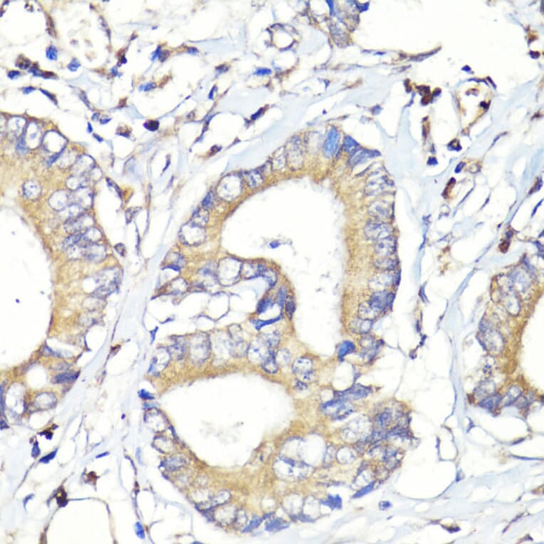 Immunohistochemistry - Anti-HBEGF / DTR Antibody (A88815) - Antibodies.com