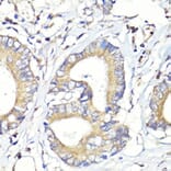 Immunohistochemistry - Anti-HBEGF / DTR Antibody (A88815) - Antibodies.com