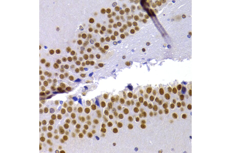 Immunohistochemistry - Anti-HP1 alpha Antibody (A88817) - Antibodies.com