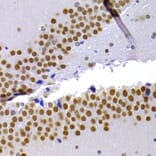 Immunohistochemistry - Anti-HP1 alpha Antibody (A88817) - Antibodies.com