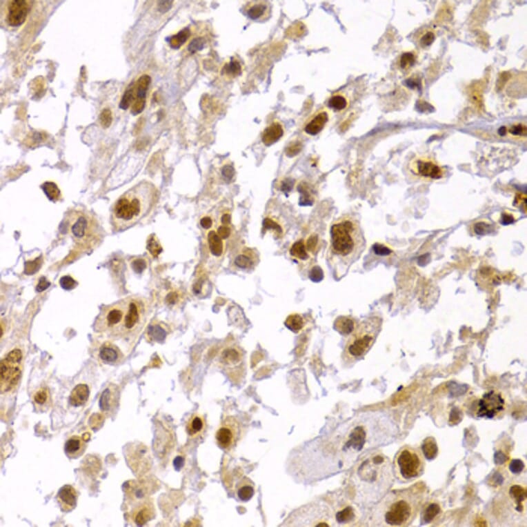 Immunohistochemistry - Anti-HP1 alpha Antibody (A88817) - Antibodies.com