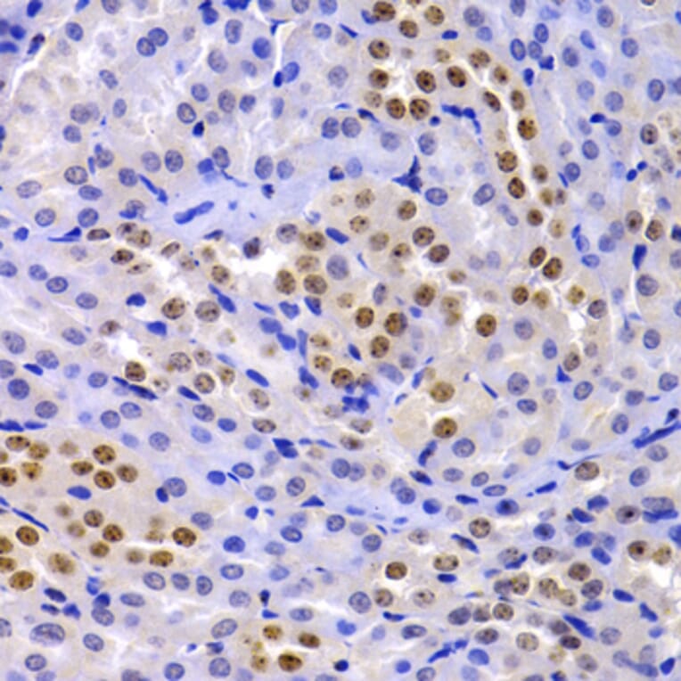 Immunohistochemistry - Anti-HP1 alpha Antibody (A88817) - Antibodies.com