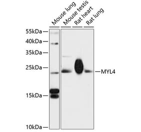 Western Blot - Anti-MYL4 Antibody (A88818) - Antibodies.com