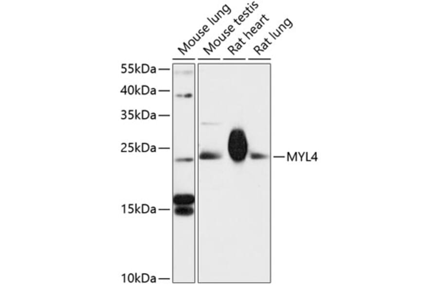 Western Blot - Anti-MYL4 Antibody (A88818) - Antibodies.com
