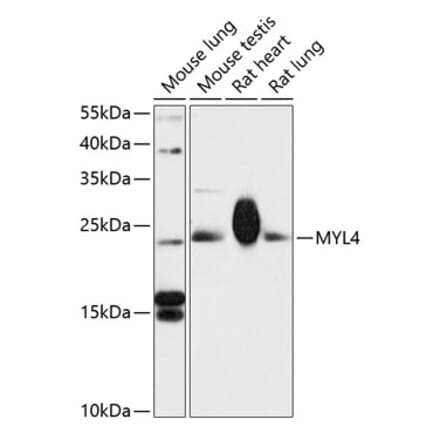 Western Blot - Anti-MYL4 Antibody (A88818) - Antibodies.com