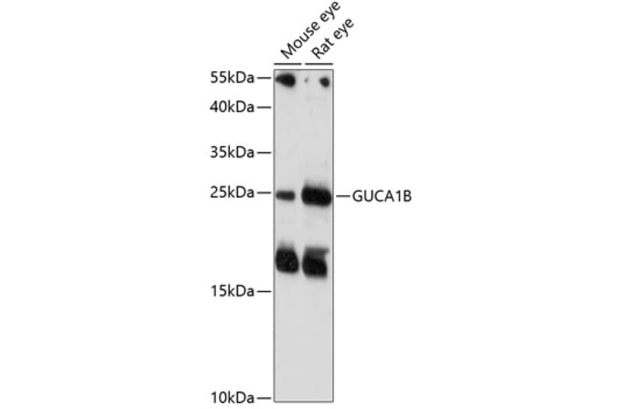 Western Blot - Anti-GCAP2 Antibody (A88819) - Antibodies.com