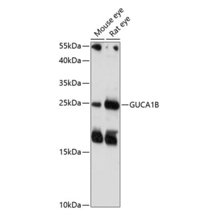 Western Blot - Anti-GCAP2 Antibody (A88819) - Antibodies.com