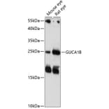 Western Blot - Anti-GCAP2 Antibody (A88819) - Antibodies.com